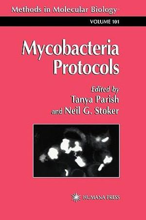 Plasmid Isolation Protocol From Mycobacterium