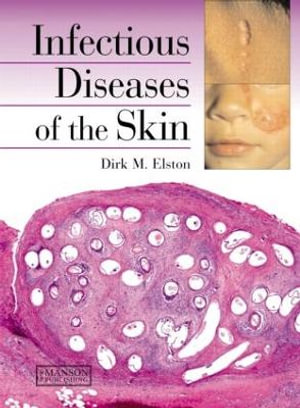 Infectious Diseases of the Skin Dirk M. Elston