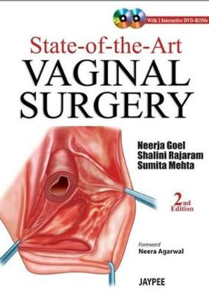 Vaginalsauger Vaginalsauger