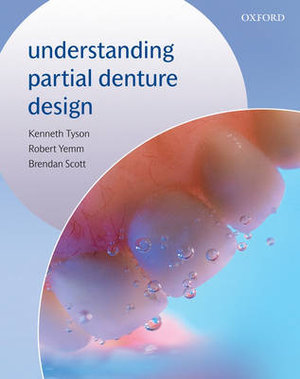 Cover of Understanding Partial Denture Design