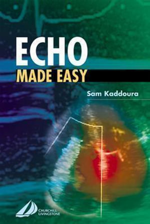 Cover of Echo Made Easy