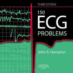 Cover of 150 ECG Problems