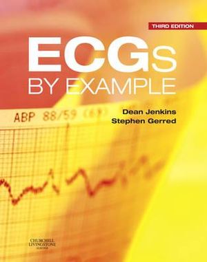Cover of ECGs by Example